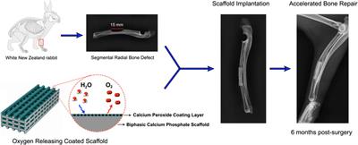 Oxygen generating biomaterials at the forefront of regenerative medicine: advances in bone regeneration